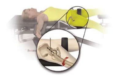 Diagram of advanced surgical table and instrument